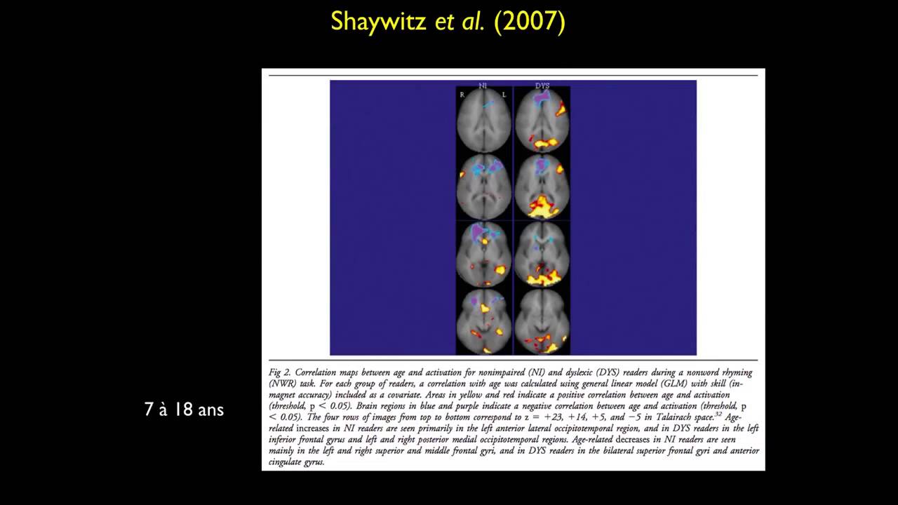 Neuroéducation, apprentissage et enseignement