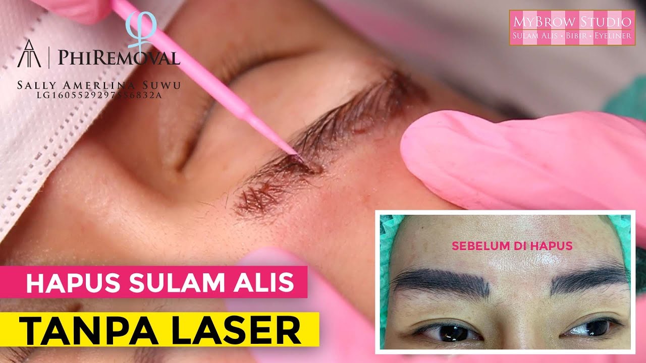 HAPUS SULAM ALIS TANPA LASER • Tanpa sakit, Proses cepat, Sulam alis hilang ❗