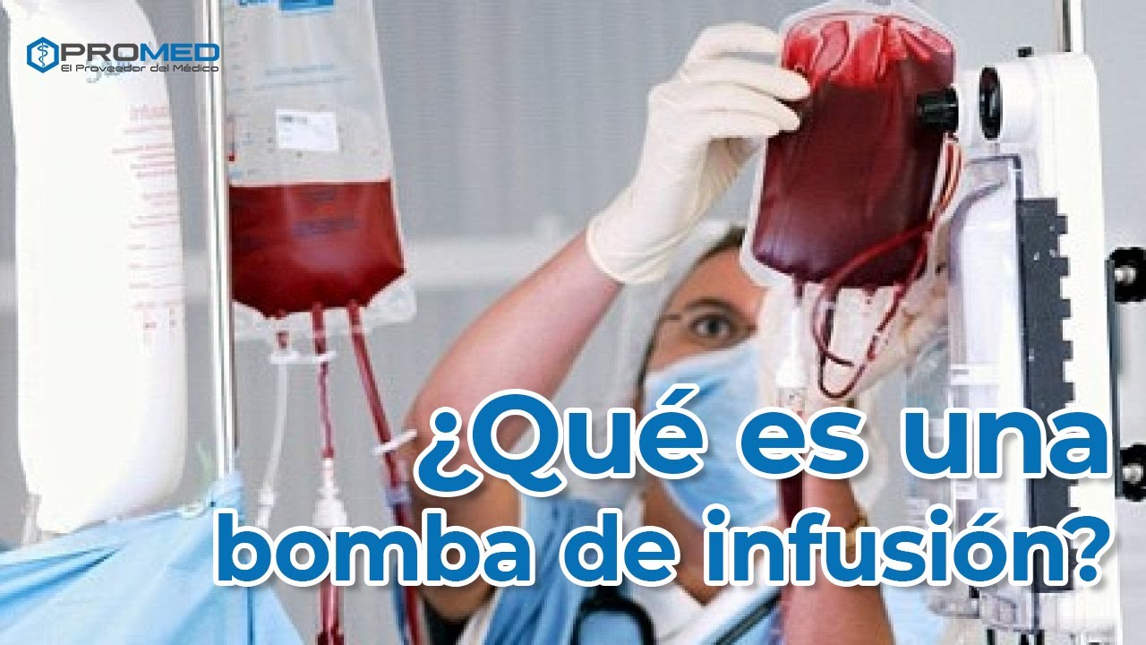 Qué es una bomba de infusión