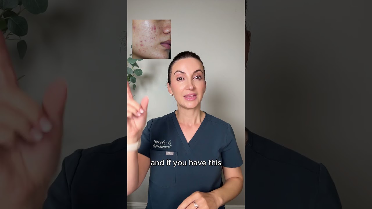 Struggling with Skin Discoloration? Watch This! #shorts #skincare #dermatologist