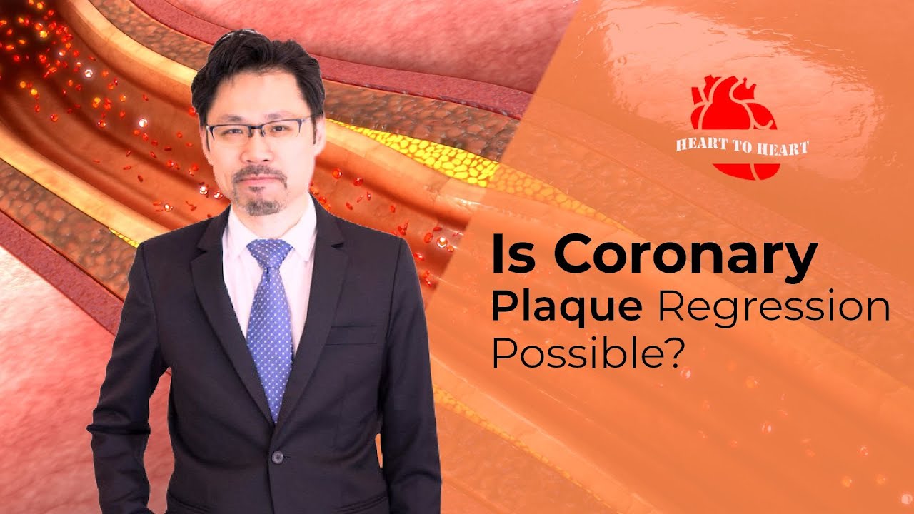 Is Coronary Plaque Regression Possible?