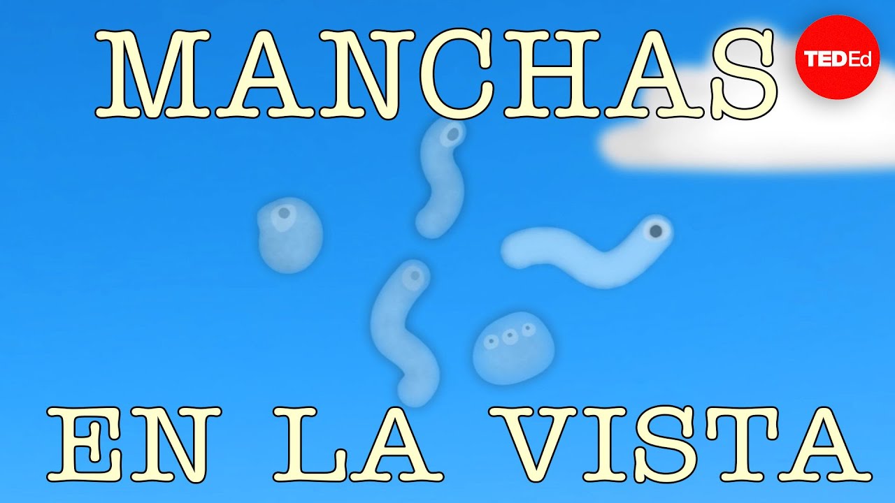 ¿Qué son esas cositas que parecen manchas en la vista? - Michael Mauser