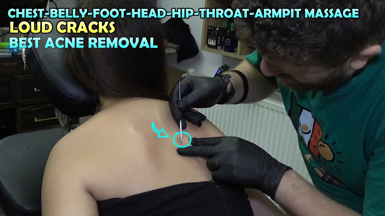 SHOULDER ACNE REMOVAL FOR LADY 🌹 LOUD CRACKS + ASMR head,face,ear,chest,belly,foot,back,hip massage