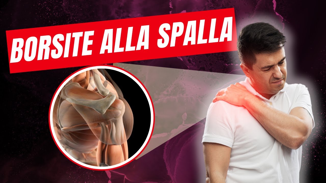 BORSITE alla spalla | RISOLVERLA in modo NATURALE (NO farmaci, NO intervento).