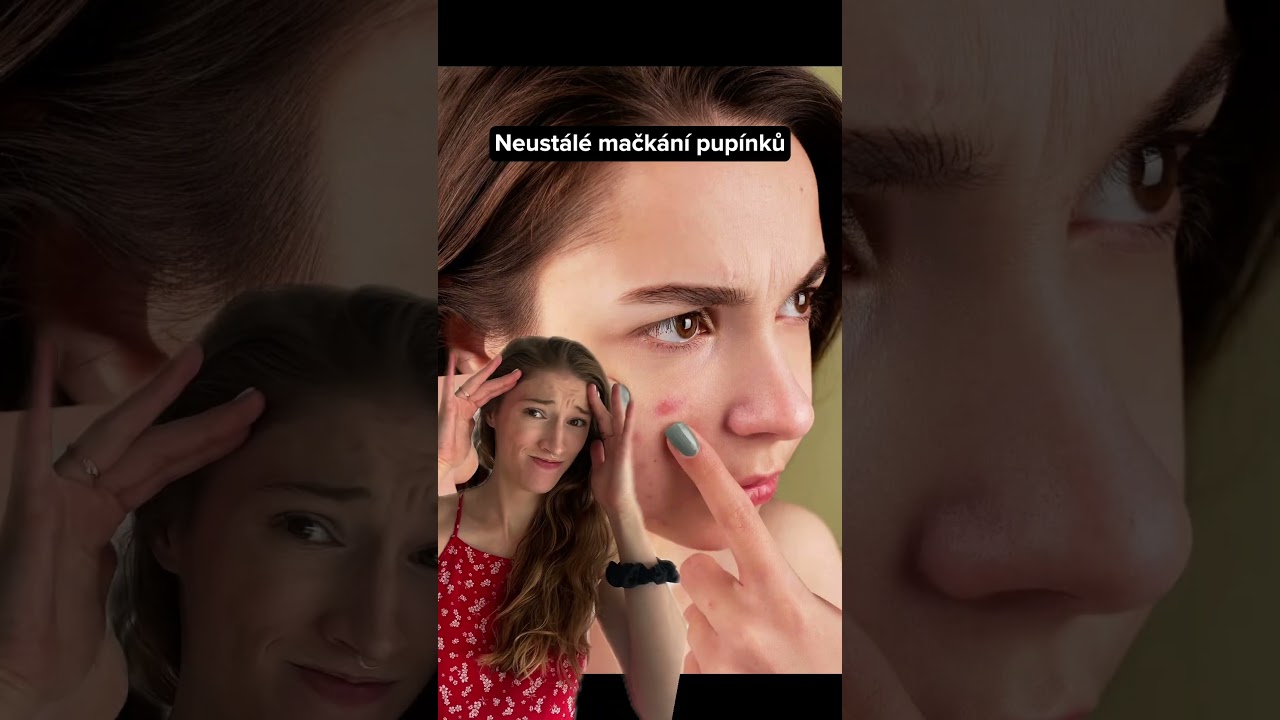 Jak se (ne)starat o pleť s akn&eacute; | LOBEY #lobey #acne #acnetreatment