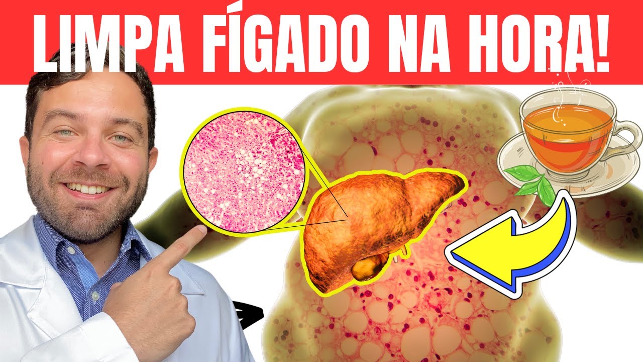 5 CHÁS INCRÍVEIS para ELIMINAR GORDURA no FÍGADO | REMÉDIO NATURAL para ESTEATOSE HEPÁTICA