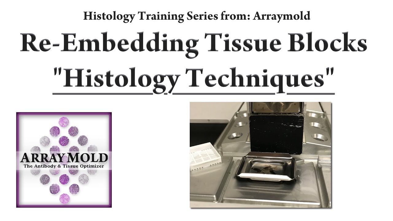 A New and Old Techniques for Re-Embedding Paraffin Tissue Blocks
