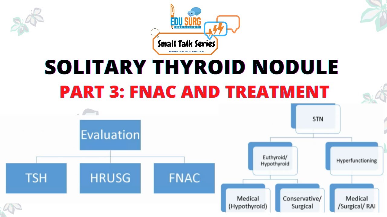 Management of solitary thyroid nodule - Part 3 - Edusurg Clinics