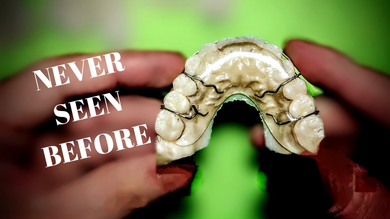 NEW HOW TO MAKE FAST CLEAR HAWLEY RETAINER TECHNIQUE