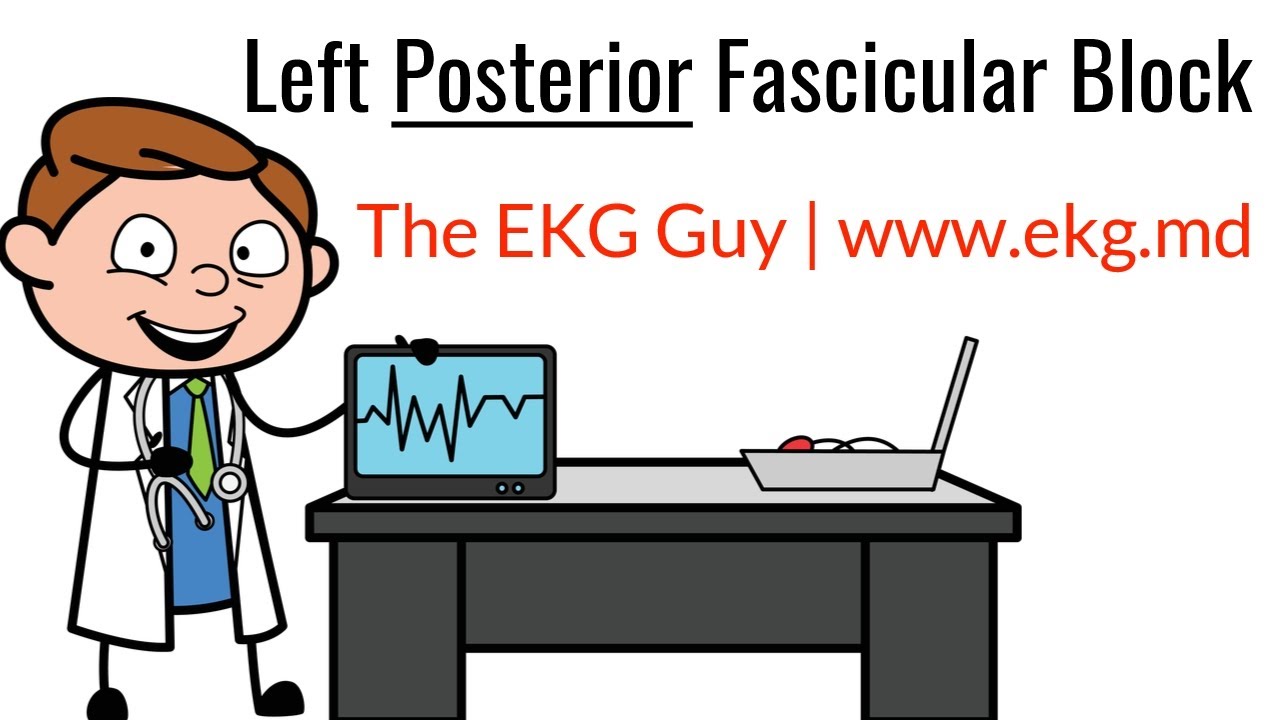 Блокада левой задней ножки пучка Гиса на ЭКГ / ЭКГ l The EKG Guy - www.ekg.md