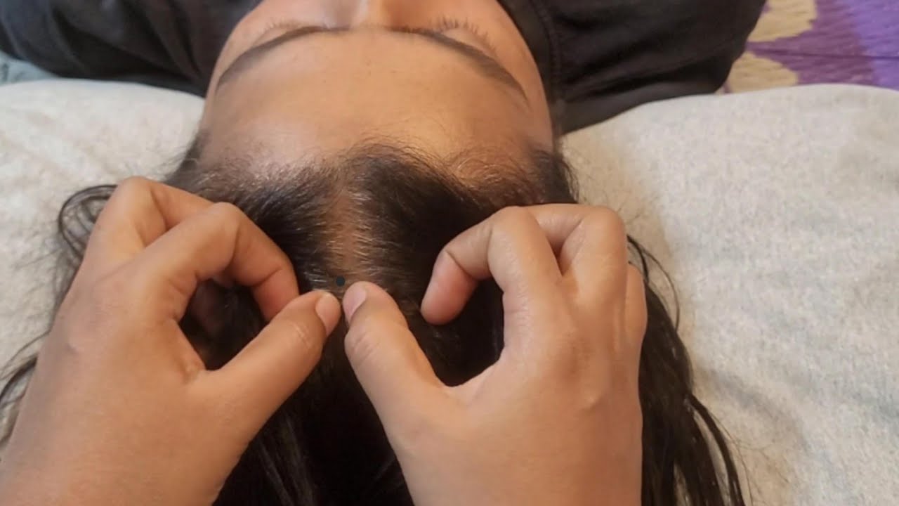 ASMR Scalp Checks: The Ultimate Tingle Test✨