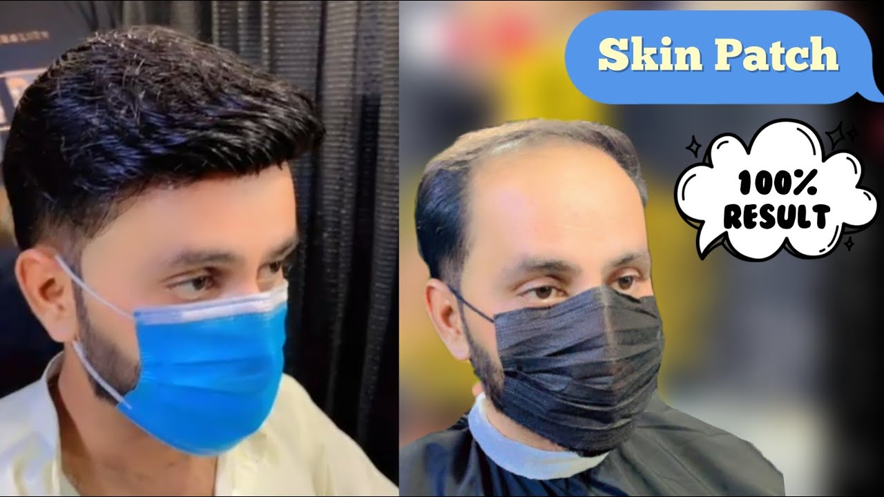 Hair System Hair Wig Hair Transformation Best Result Hair Unit whatsapp: 03004272353