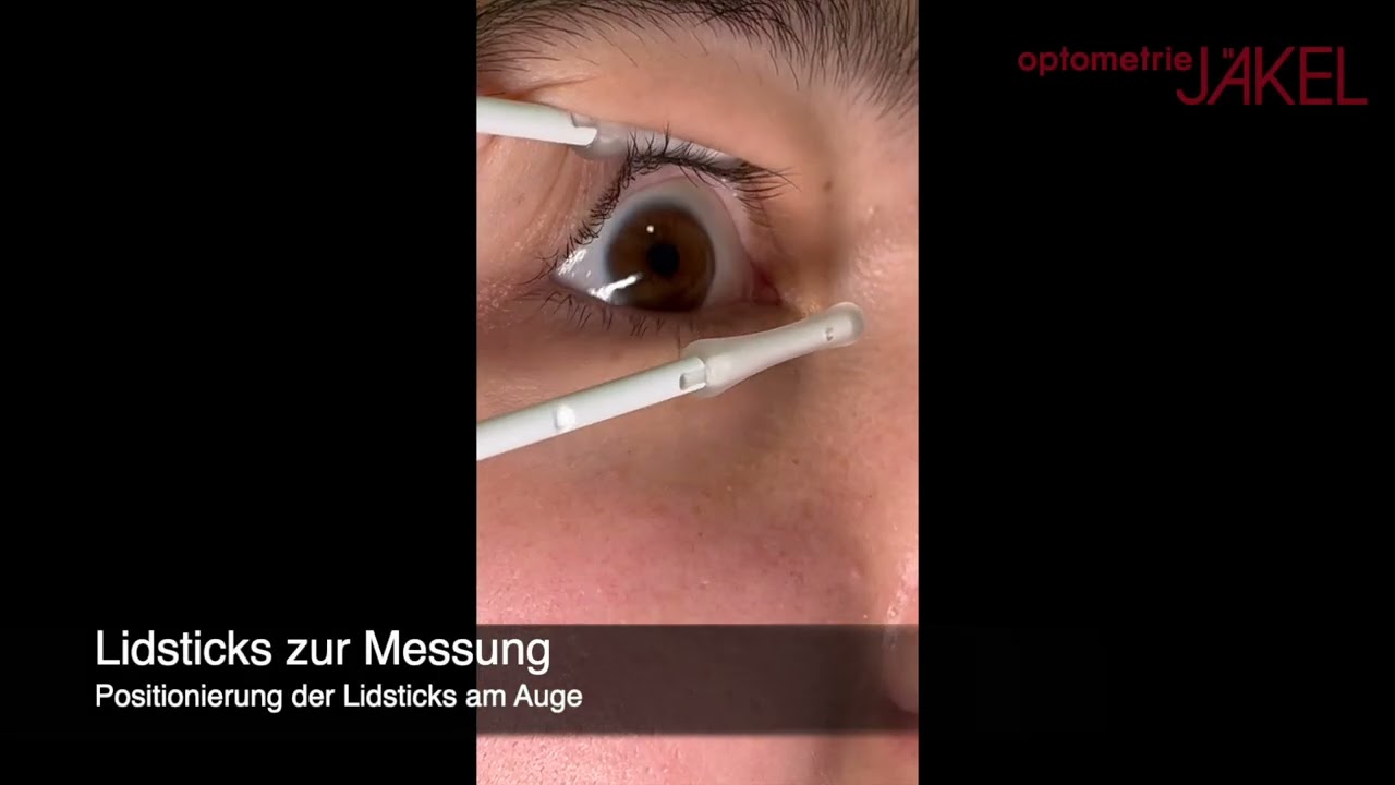 Anwendung der Oculus Lidsticks im Kontaktlinsenzentrum von optometrie J&auml;kel in Kelheim