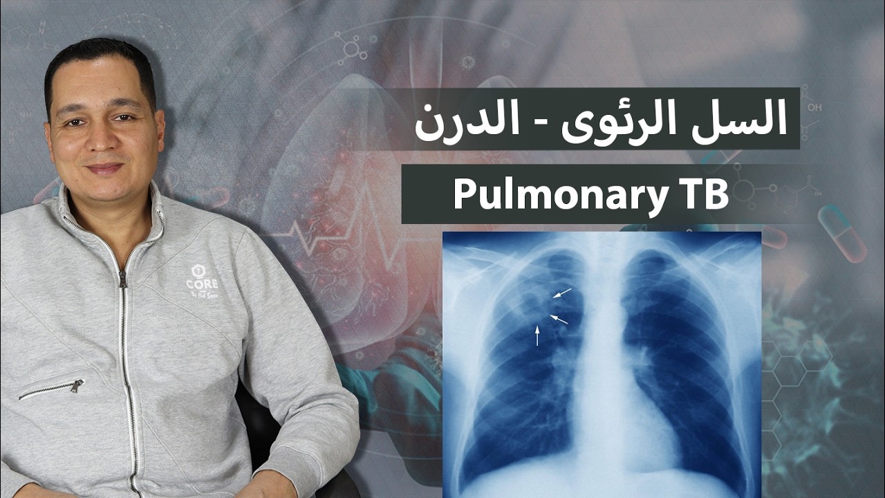 الدرن / السل الرئوى / Pulmonary TB