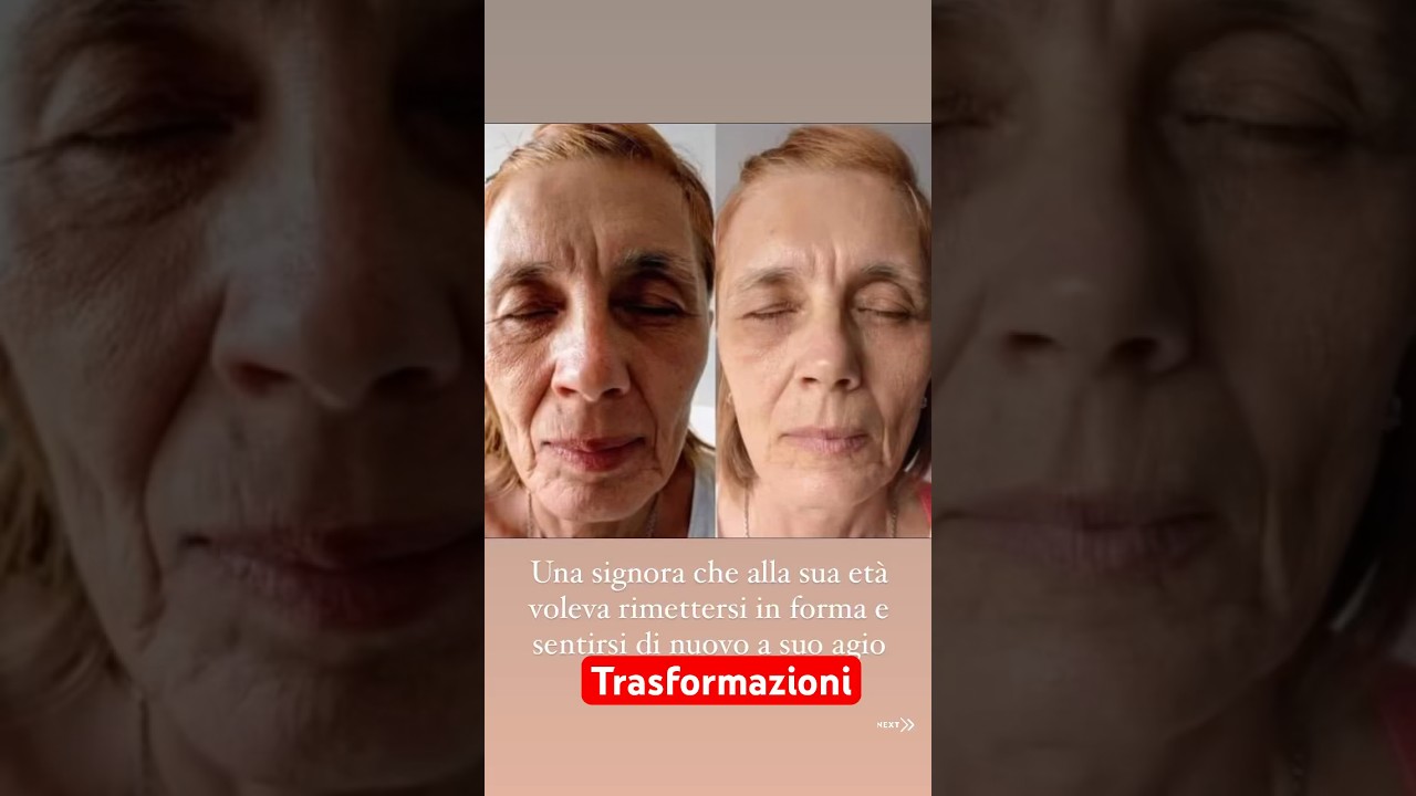 Trasformazioni #nuskin #pharmanex #bellezza #beauty #curadise #dispositivi #rughe #antieta #zigomi