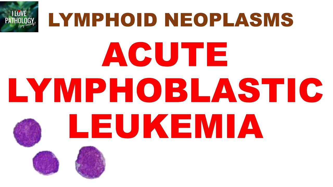 Acute Lymphoblastic Leukemia (ALL) – Epidemiology, Pathogenesis, Morphology, Clinical Features