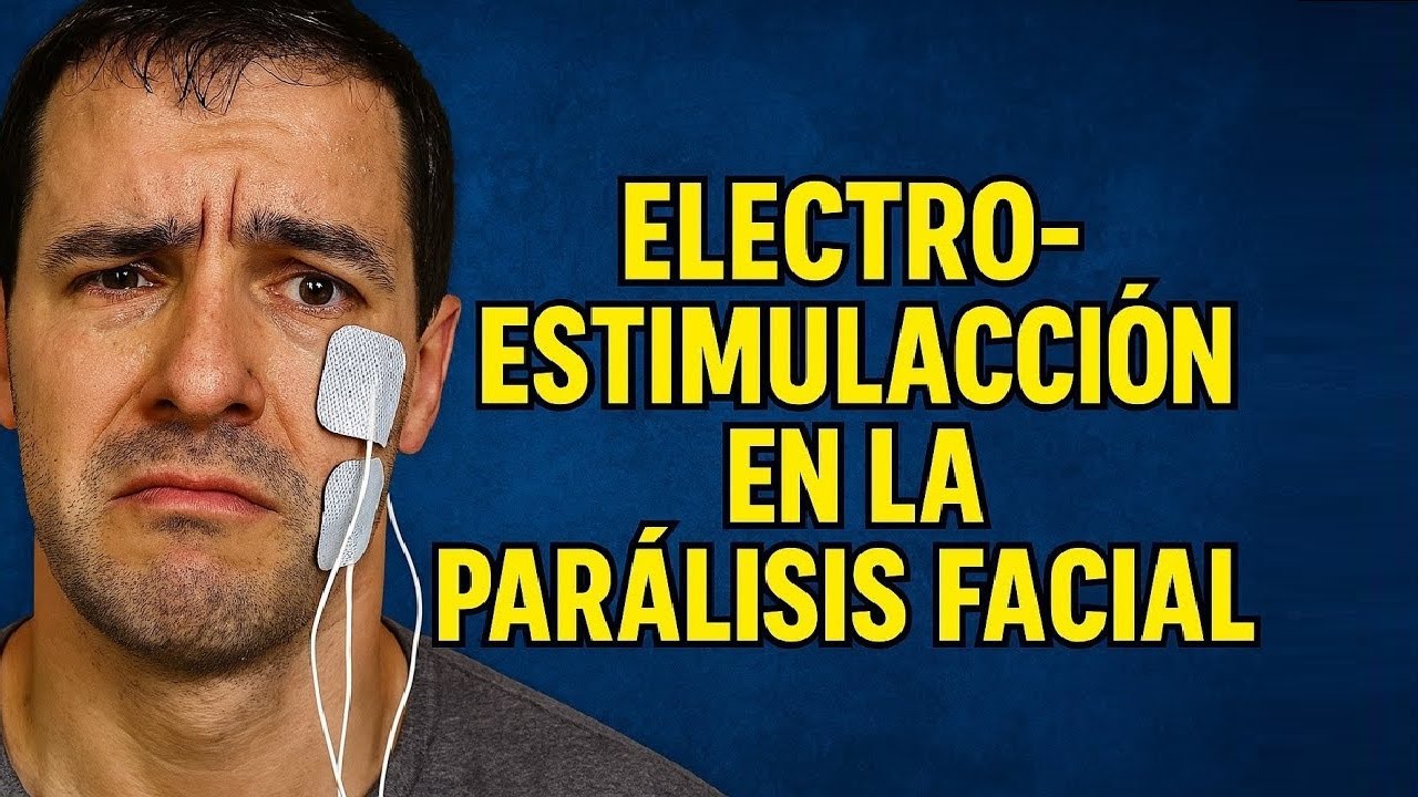 Parálisis Facial y Electroestimulación: ¿Cómo Evitar Secuelas?