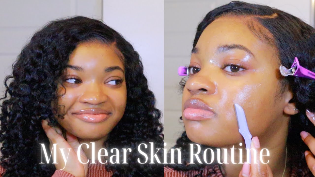 HOW I ACHIEVE GLOWY, GLASSLIKE SKIN!!! | GET RID OF DRY, ECZEMA SKIN!!! | VLOGMAS DAY 14!!!