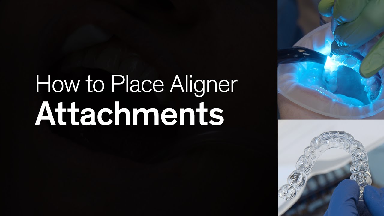 How to Place Attachments | Smilers® Aligners