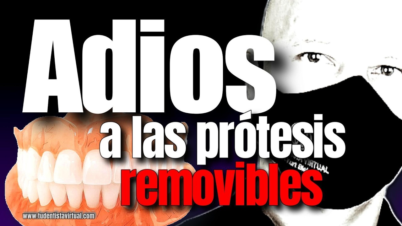 LA MEJOR FORMA de REEMPLAZAR la PROTESIS DENTAL sin TENER MUCHO HUESO en las ENCÍAS