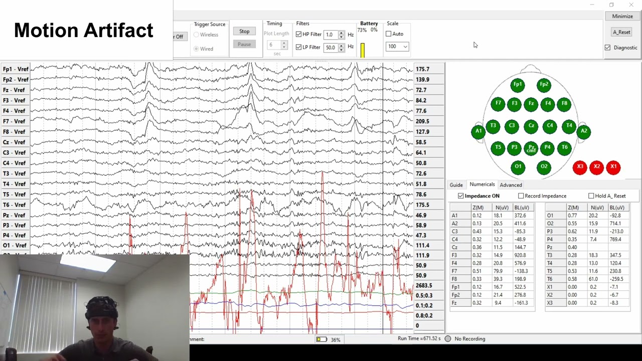 DSI Dry EEG signal quality