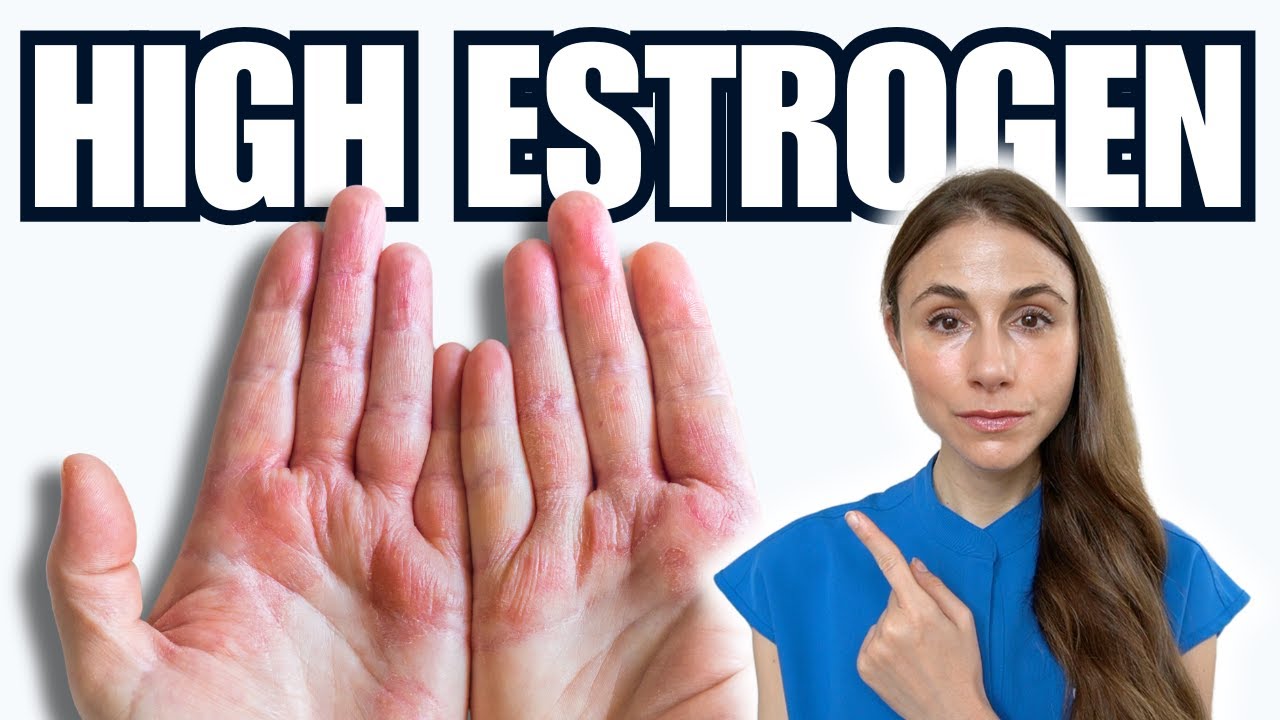 7 Warning Signs Of High Estrogen NOT TO MISS (Skin & Hair)