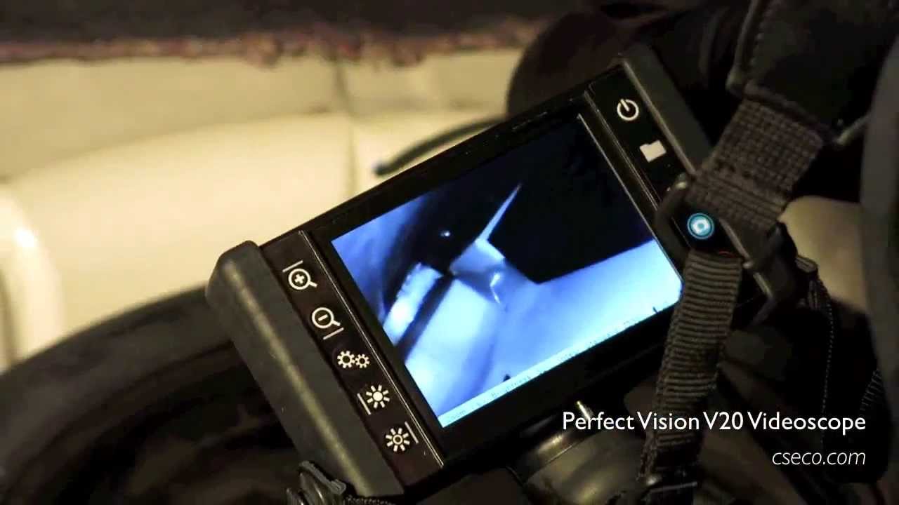 CSECO - Perfect Vision&reg; V20 Videoscope Inspection System - In Use During Routine Stop