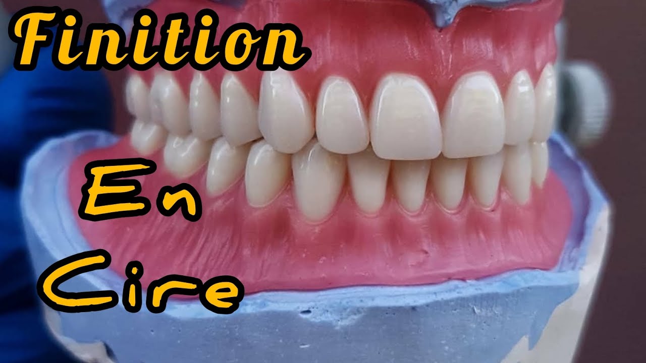 Finition en cire de prothese total