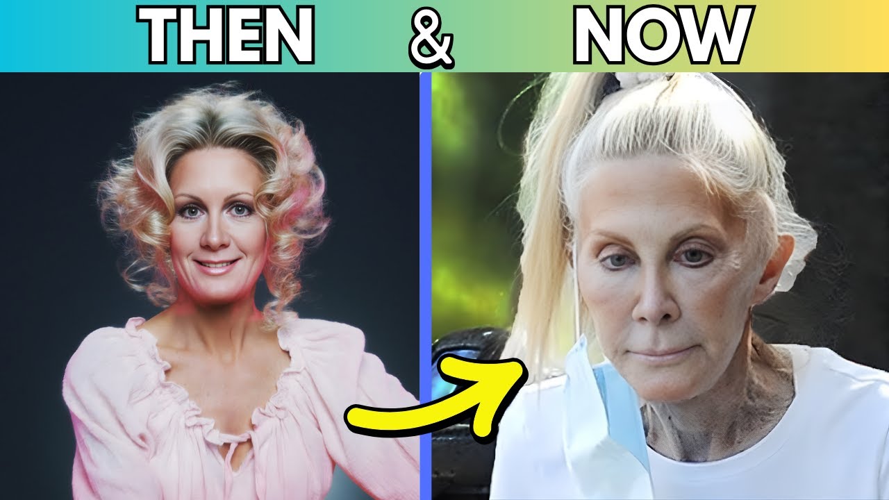 Joan Van Ark is Unrecognizable! + 45 Plastic Surgery Cases (Then vs Now)