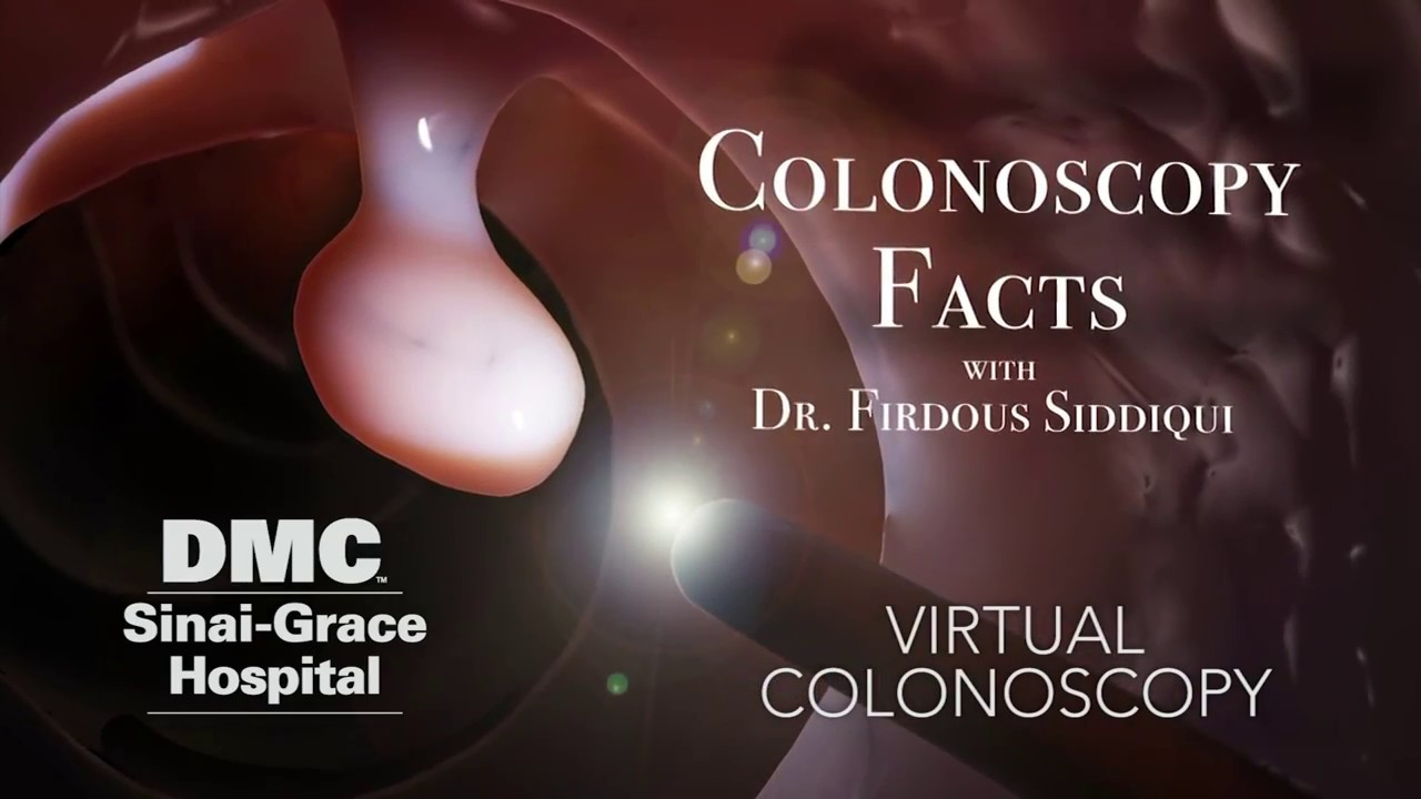 What is a Virtual Colonoscopy and can I get one as an alternative to a full one?