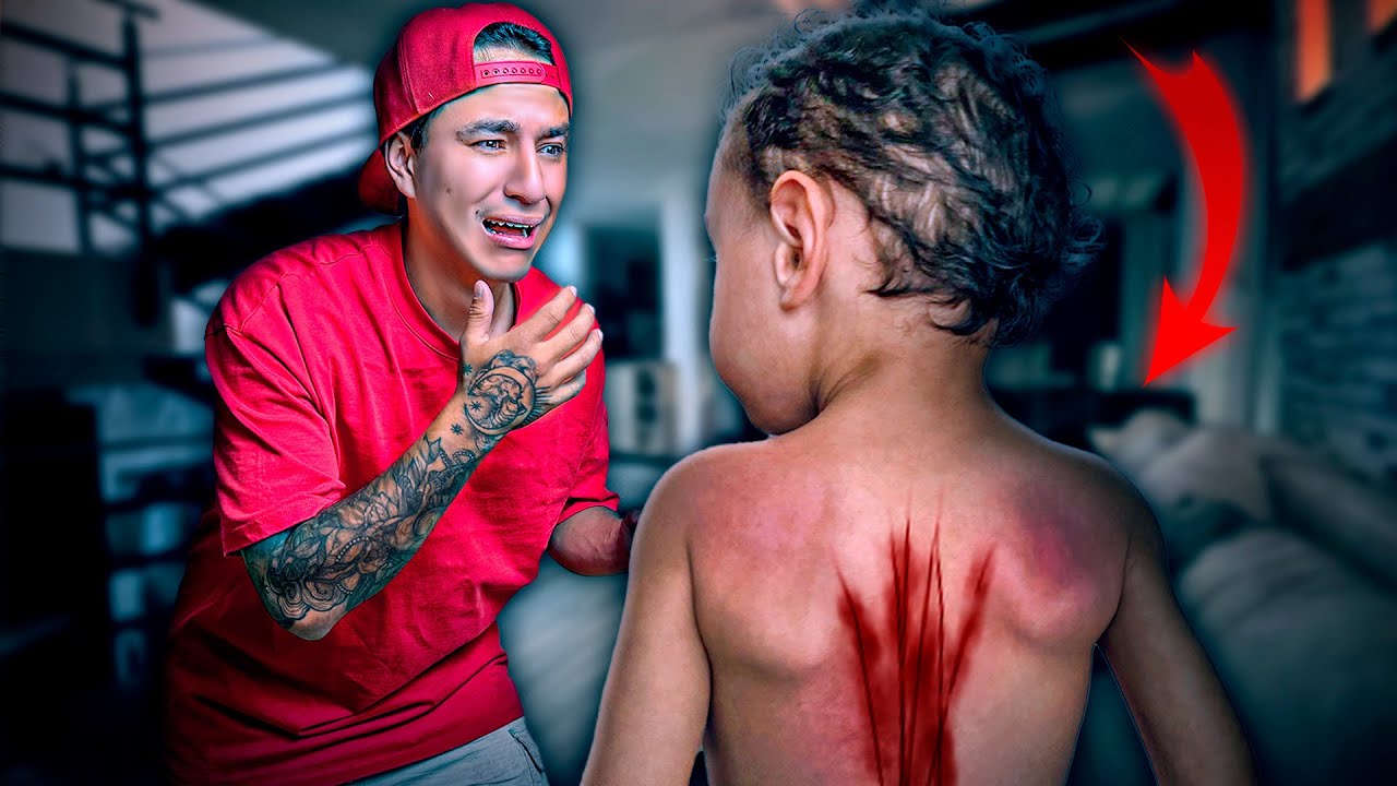 ¡MI HIJO TIENE una MARCA MALDITA en SU ESPALDA!