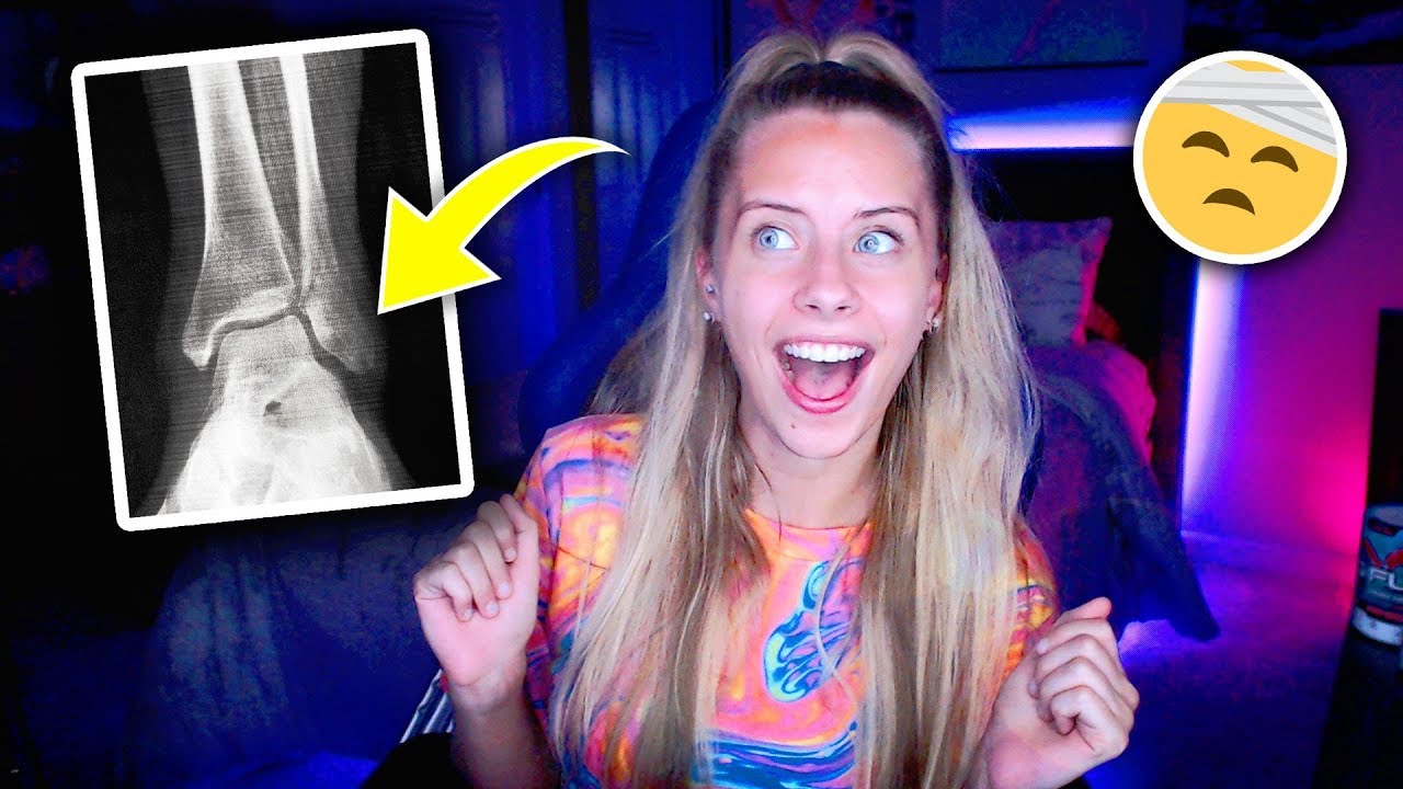 I BROKE MY ANKLE in a fUnNy way! w0w! ~ (BO4 kinda)