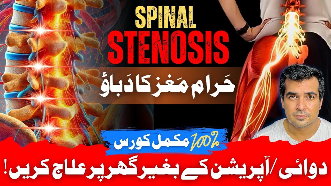 Spinal Stenosis Home Treatment | Complete Course | Dr. Naseem Abbas