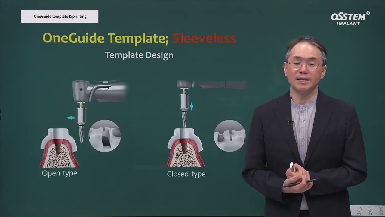 OneGuide template & printing. Master Course SURGERY.