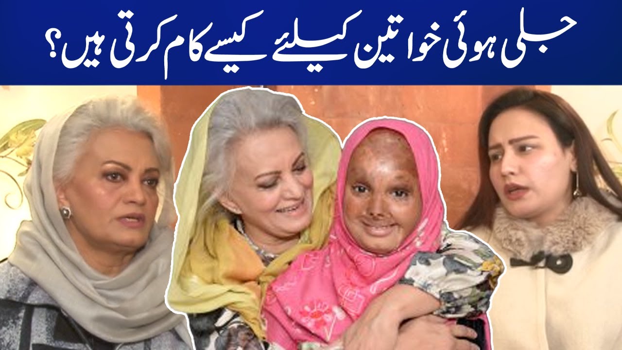 How Musarrat Misbah Helps Burned Womens? | Weekend | Capital TV