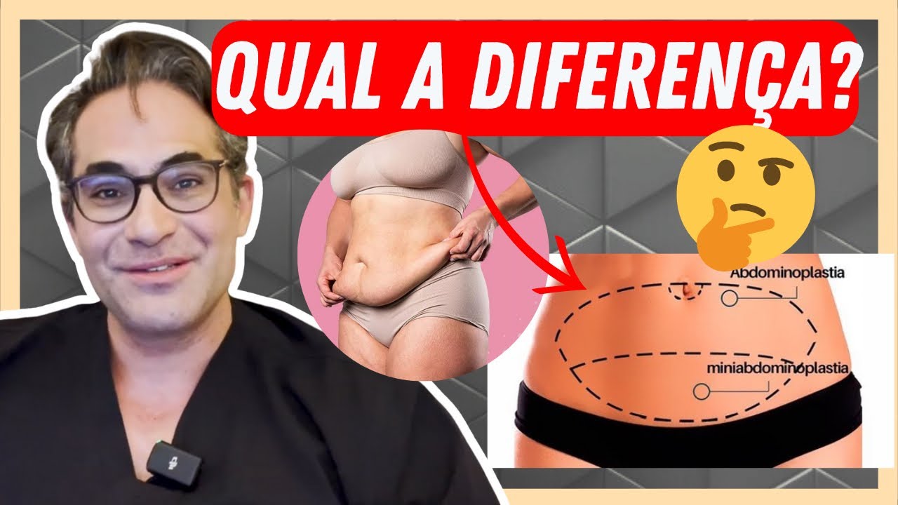 MINI ABDOMINOPLASTIA: tudo que você precisa saber sobre a cirurgia