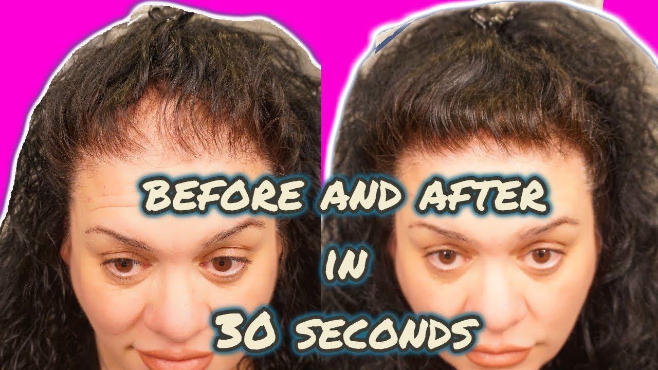 How I Created a FULL HAIRLINE IN 30 SEC WITH NO HAIR EXTENSIONS!!