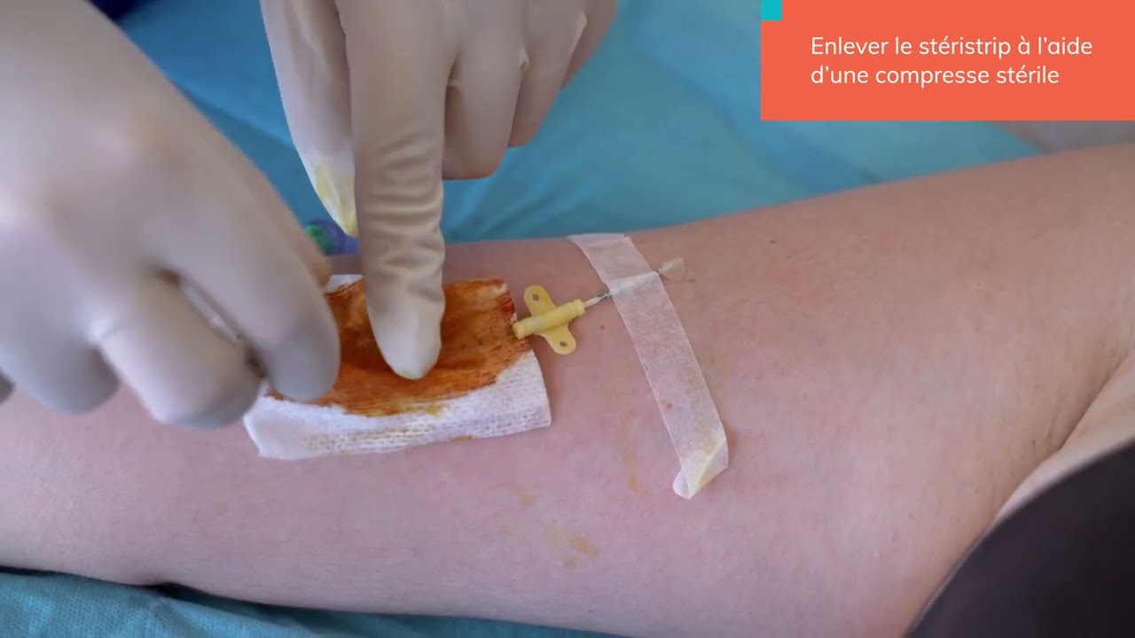 Réfection de pansement PICC ou MIDLINE