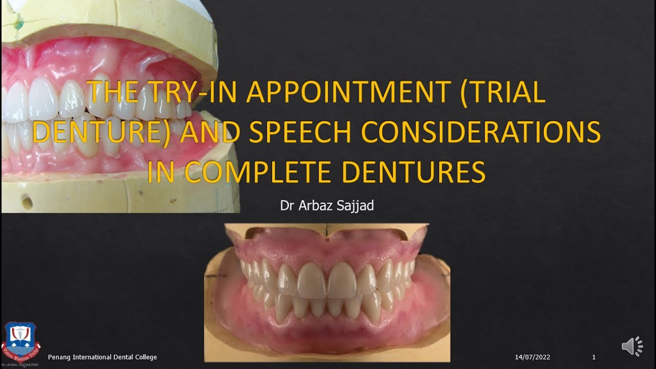THE TRY IN APPOINTMENT  AND SPEECH CONSIDERATIONS IN COMPLETE DENTURES