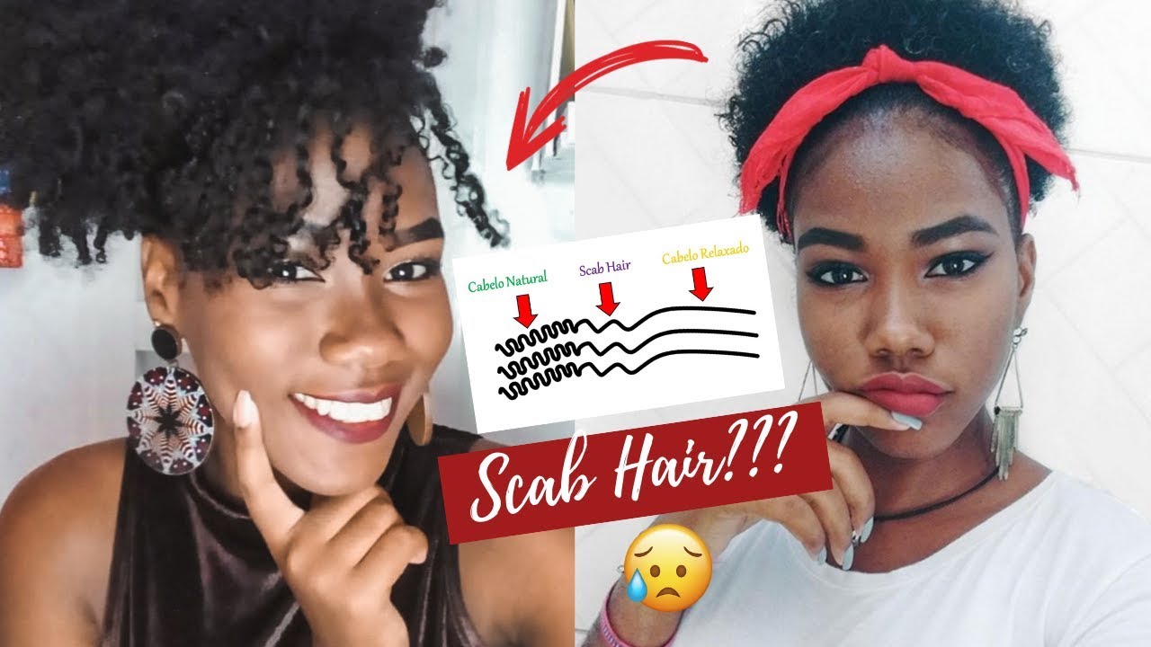 O QUE &Eacute; SCAB HAIR?? FICA PARA SEMPRE? | Andreza Siltos