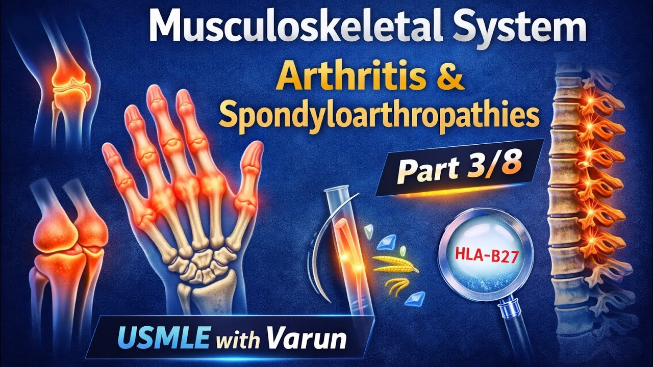 Arthritis| Rheumatoid Arthritis, Osteoarthritis & Spondyloarthropathies | MSK Part 3/8 (USMLE)