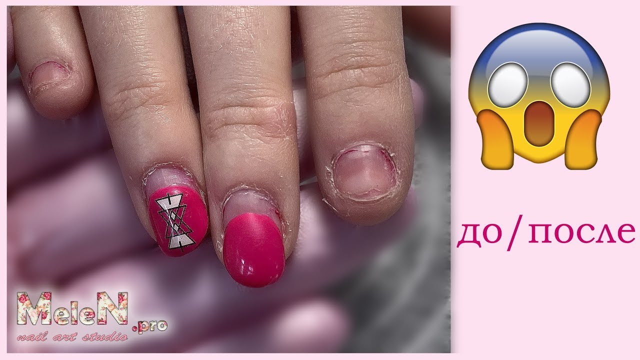 Комбинированный маникюр 💅 Восстановление ногтей