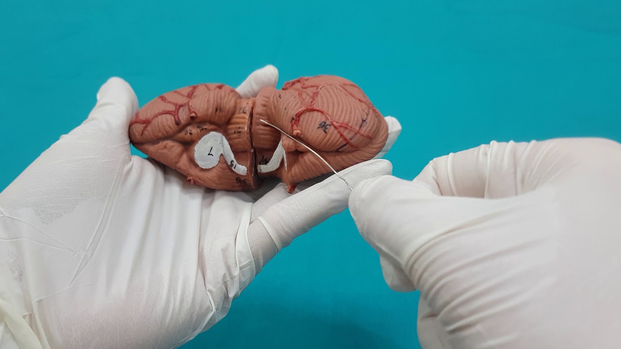 Cerebellum (Beyincik) Anatomisi+Vermis'in karşılıkları (Ayrıntılı video)|Nöroanatomi (2.Bölüm)