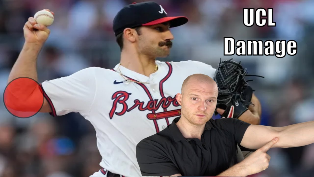Spencer Strider Injury Update!  Spencer Strider Elbow Injury Explained