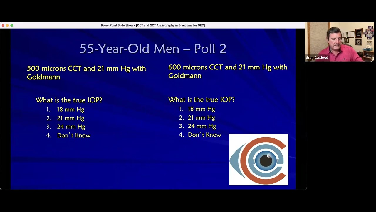 OCT and OCT Angiography in Glaucoma