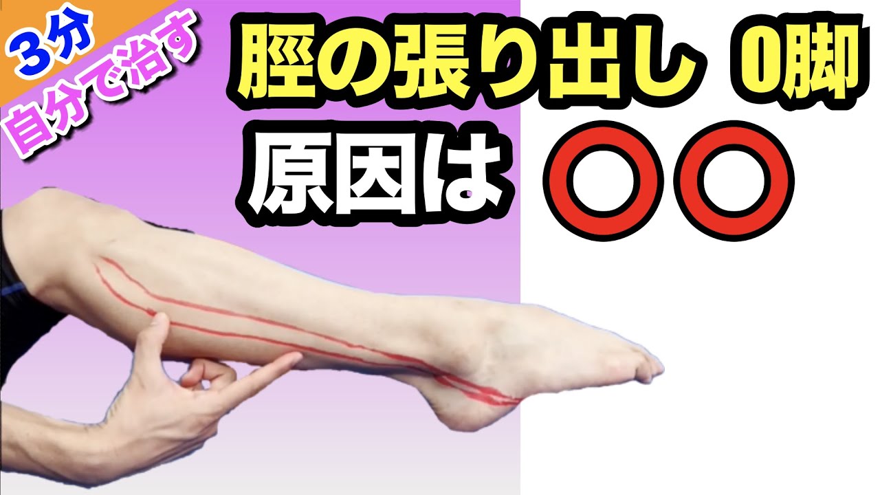 膝下O脚 かま足改善バレエ パーソナルトレーニング 大阪