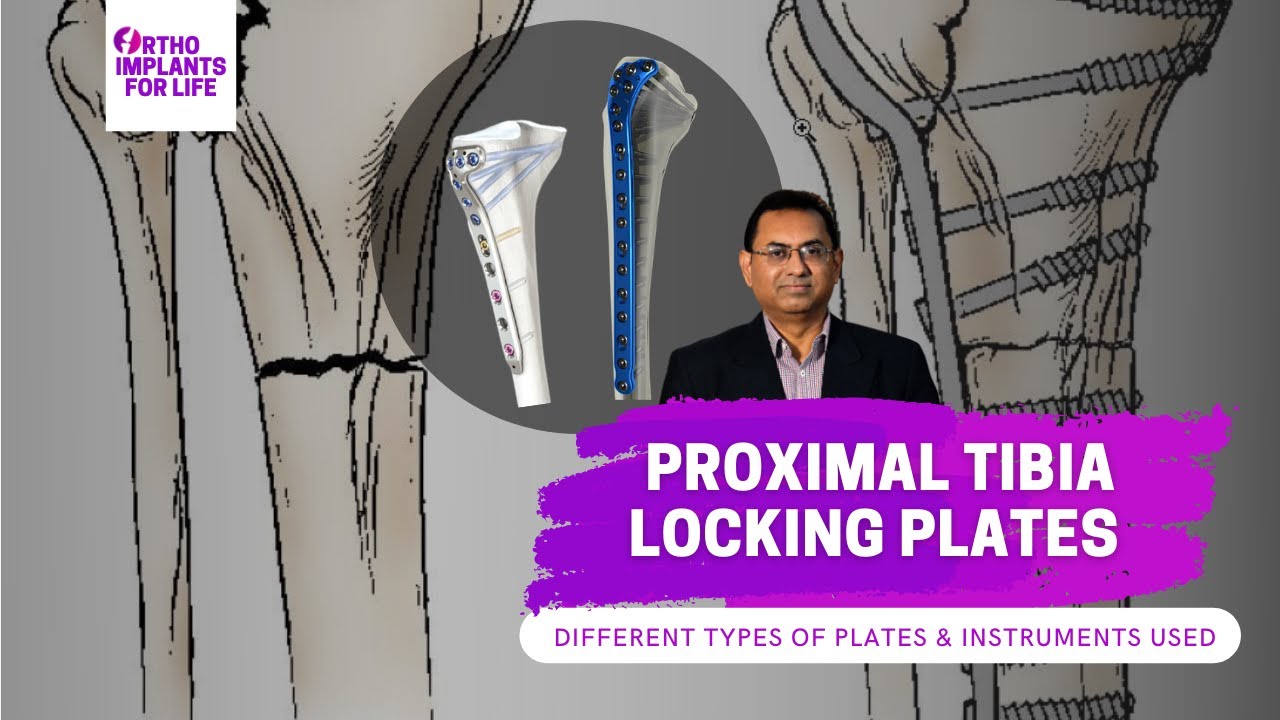 Proximal Tibia Locking Plates | Types of Plates & Instruments