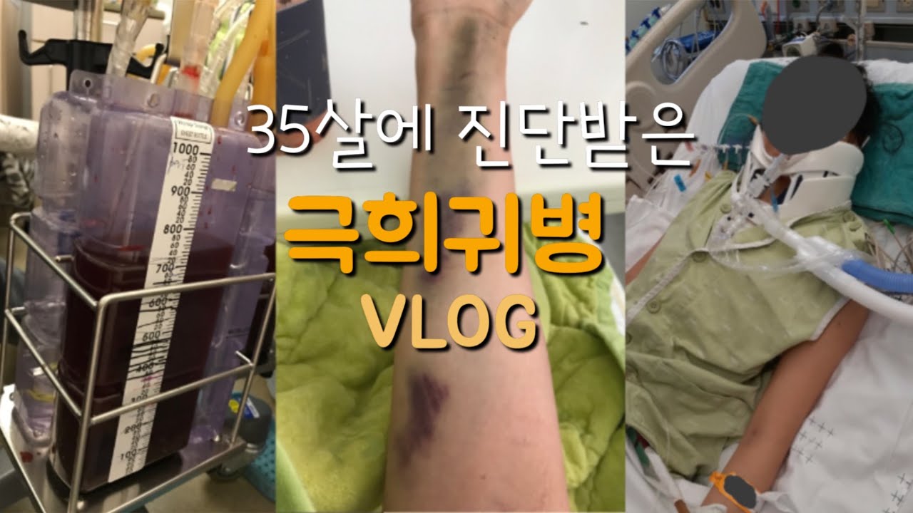 일상vlog|35살에희귀병진단받다|응급수술|시각장애