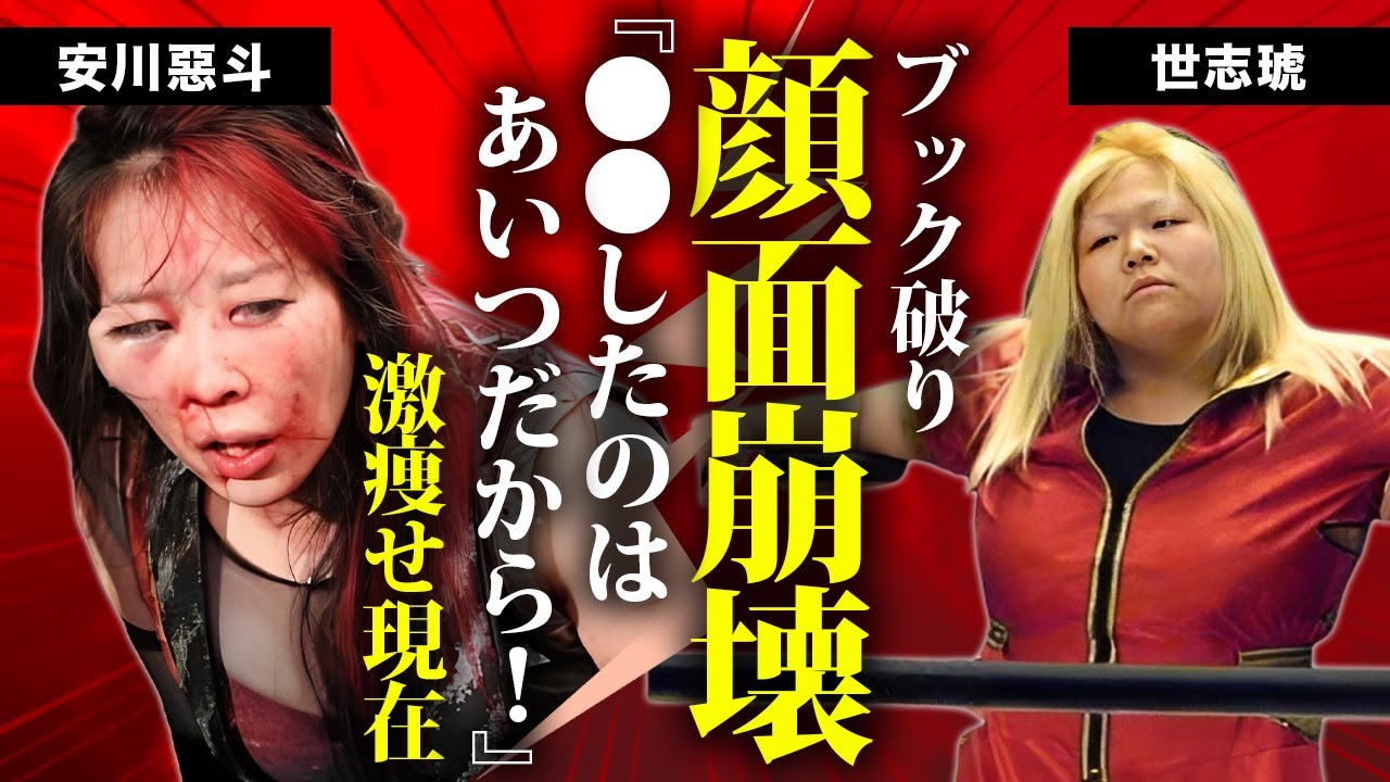 世Ⅳ虎が安川惡斗を&rdquo;顔面崩壊&rdquo;させた本当の理由...