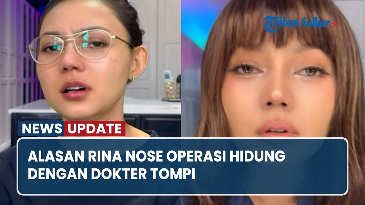 Alasan Rina Nose Operasi Hidung dengan Dokter Tompi, Soroti Hasil yang Natural